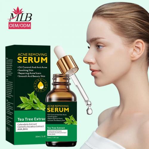 acne serum